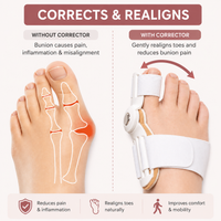 Elite Toe Corrector